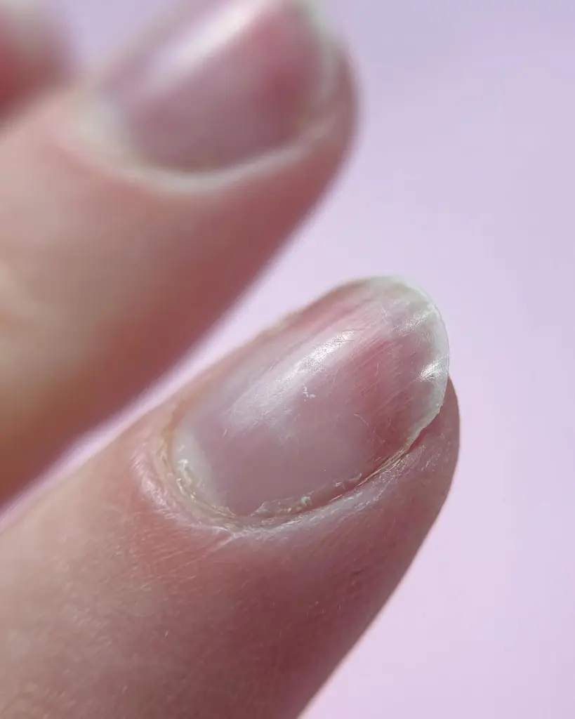 before-japanese-manicure